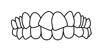 Generally-Straighter-Teeth